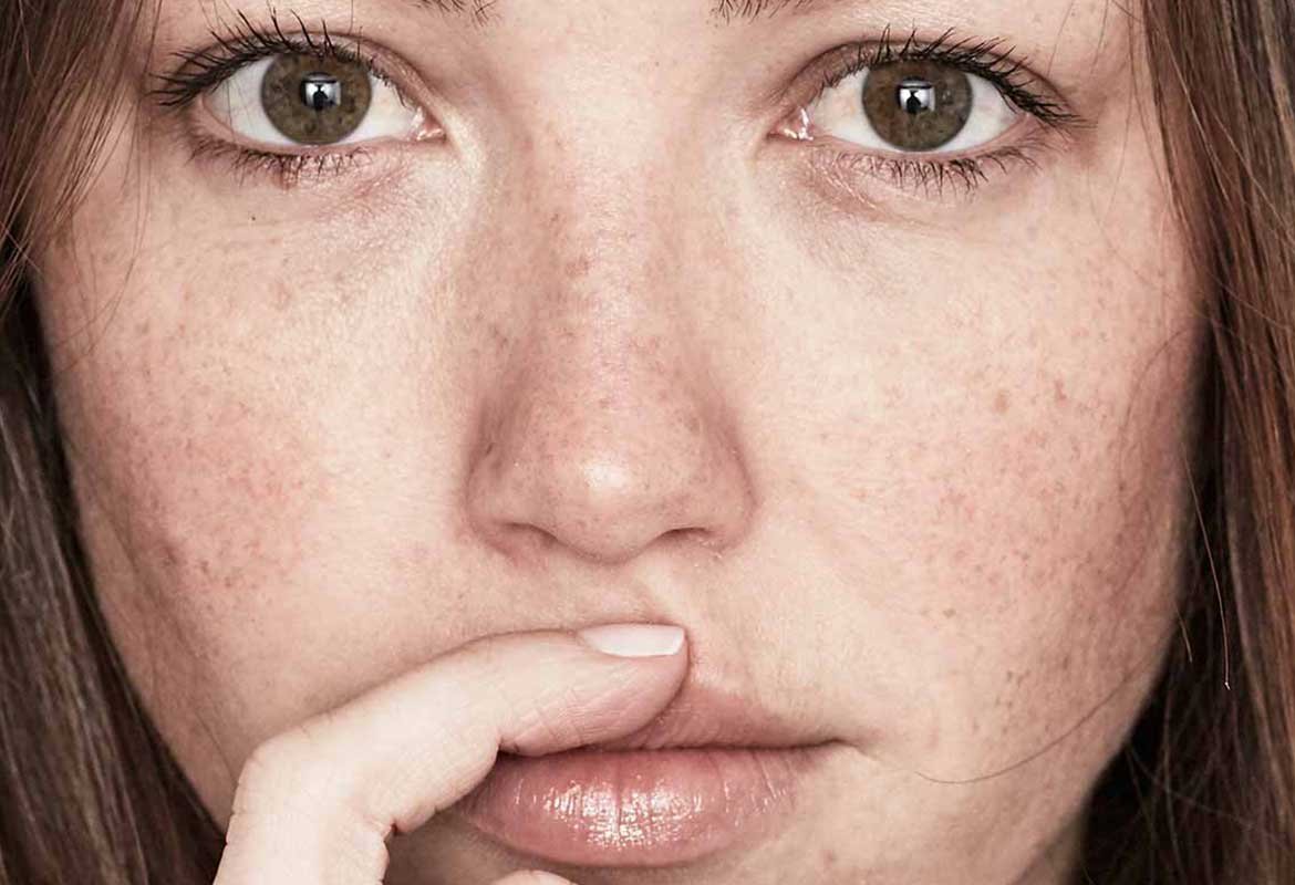 Labios Secos Causas